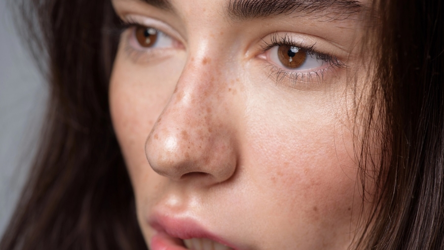 routina-peripoihshs-derma-panades-kilides