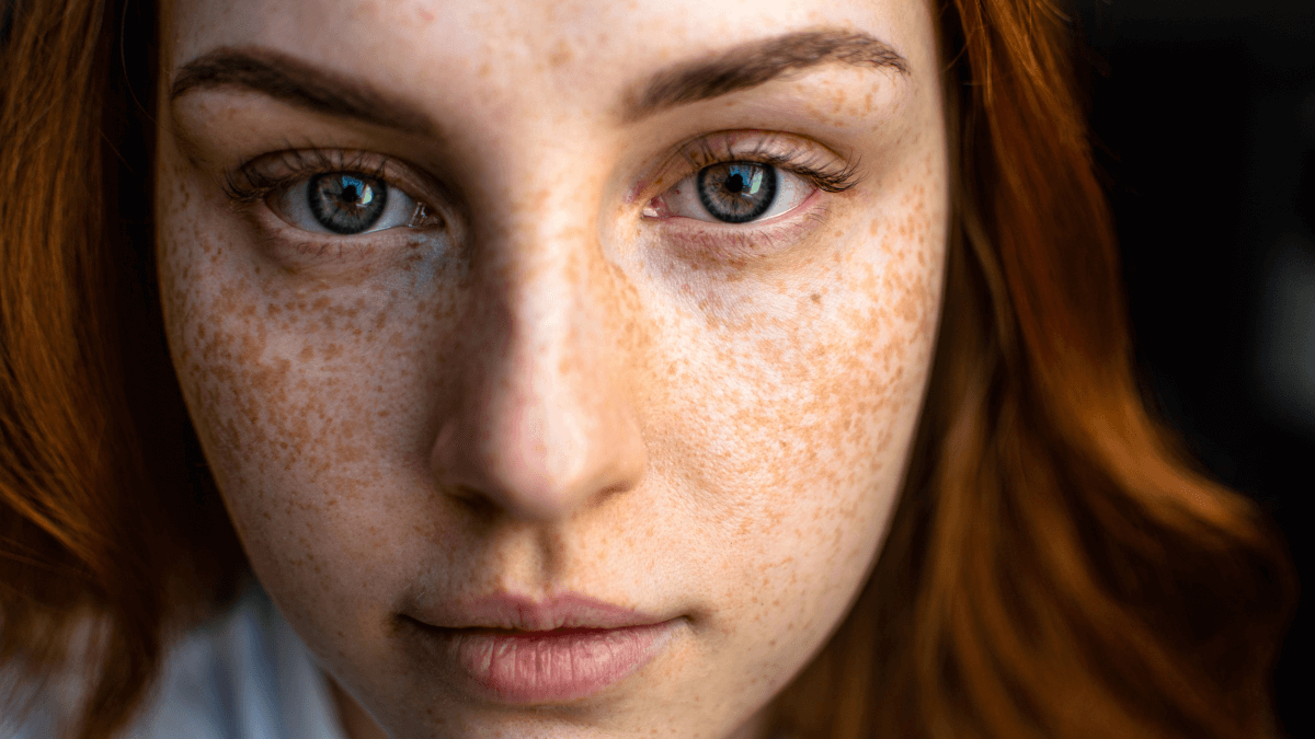 spots (1)
